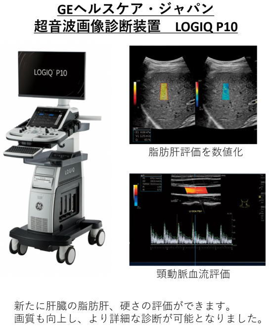 超音波画像診断装置　LOGIQ P10